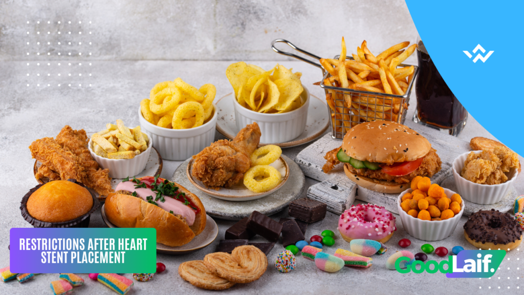 Restrictions After Heart Stent Placement