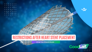 Restrictions After Heart Stent Placement
