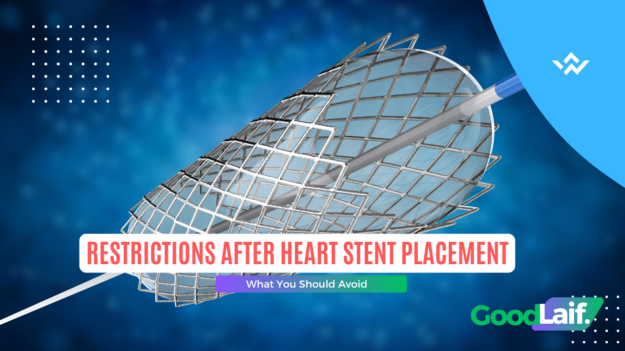 Restrictions After Heart Stent Placement