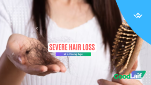 Severe Hair Loss at a Young Age: Here’s How to Overcome It