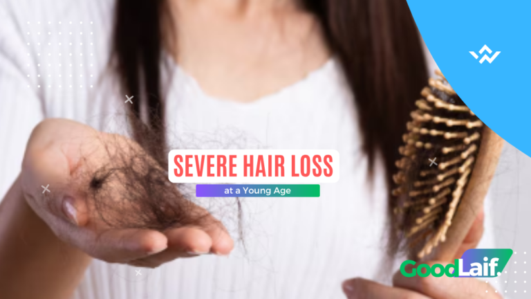 Severe Hair Loss at a Young Age: Here’s How to Overcome It