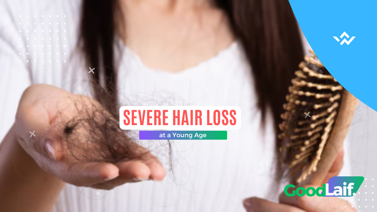 Severe Hair Loss at a Young Age: Here’s How to Overcome It