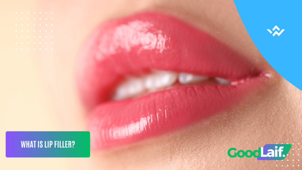 Lip Filler