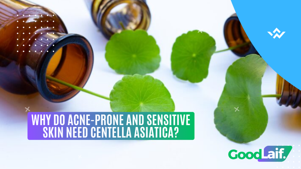 Why Do Acne-Prone and Sensitive Skin Need Centella Asiatica?