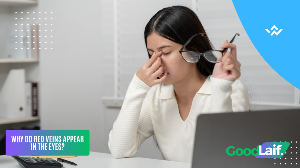 Red Veins in the Eyes