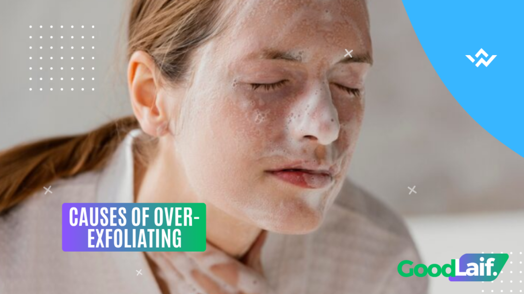 Causes of Over-Exfoliating