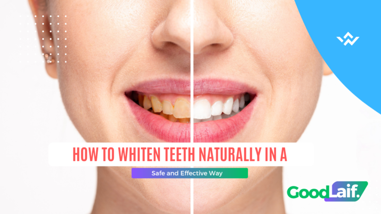 How to Whiten Teeth Naturally in a Safe and Effective Way