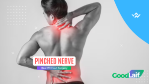 Pinched Nerve Heal Without Surgery