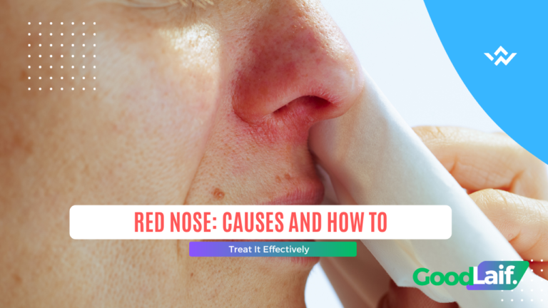 Red Nose: Causes and How to Treat It Effectively