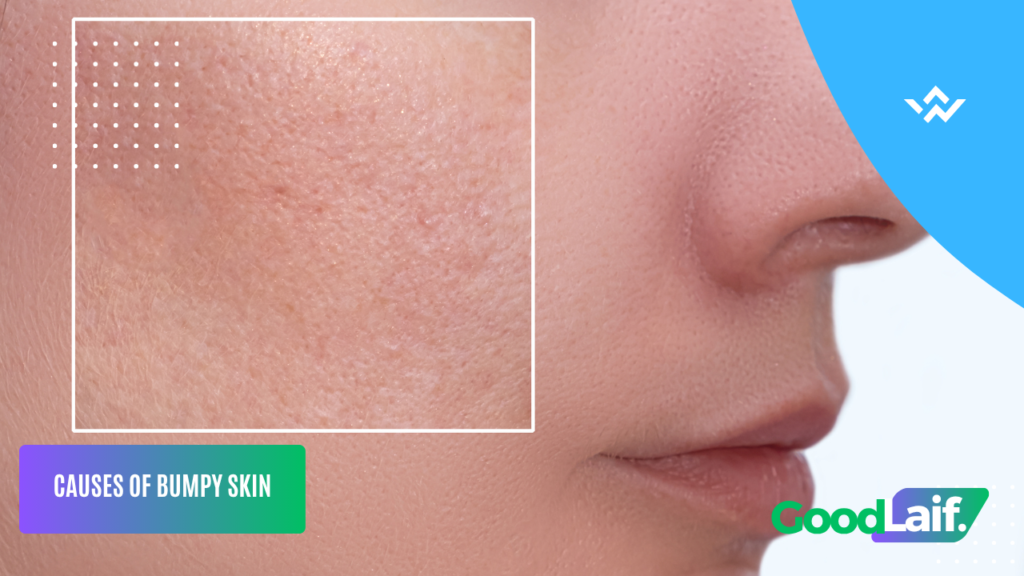 Skincare Ingredients for Bumpy Skin