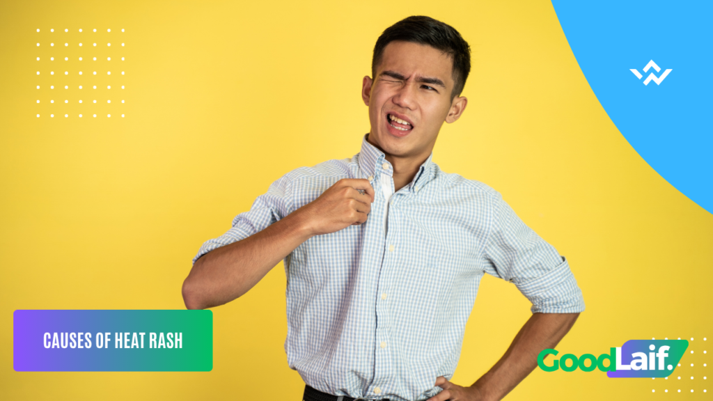 How to Get Rid of Heat Rash