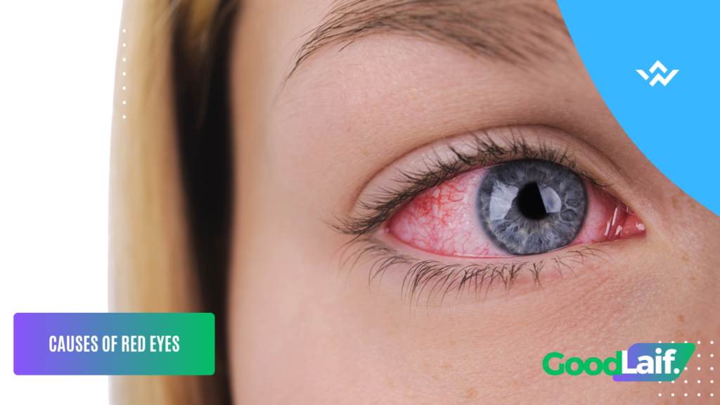 Red Eye Drops