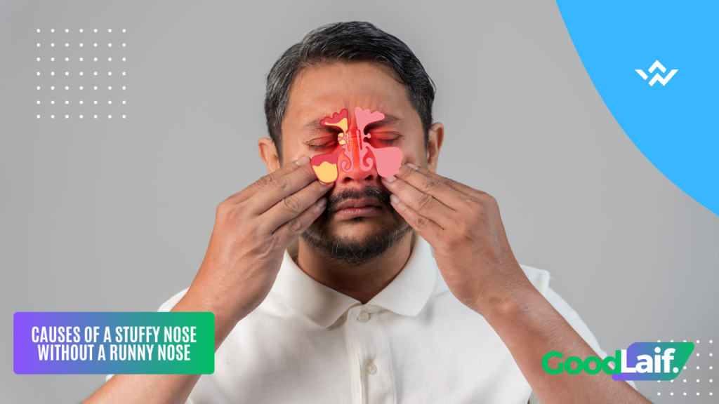 Stuffy Nose Without a Runny Nose