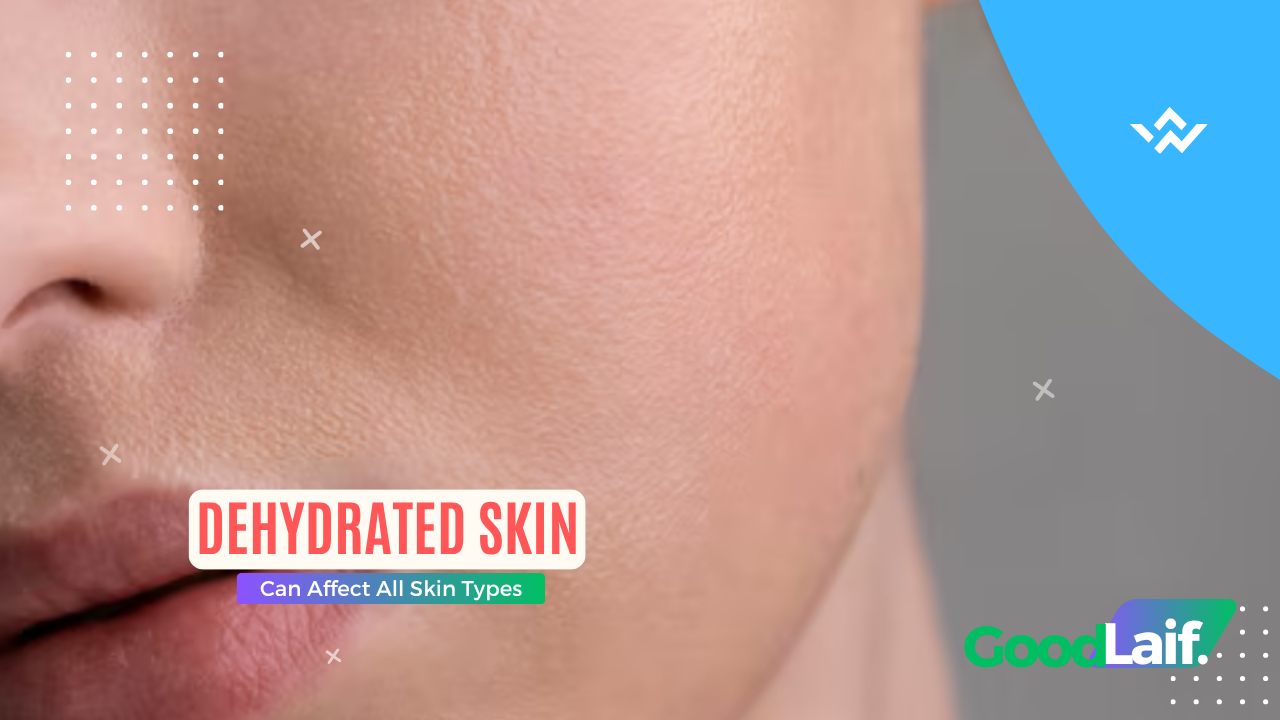Dehydrated Skin Can Affect All Skin Types, Here’s the Fact