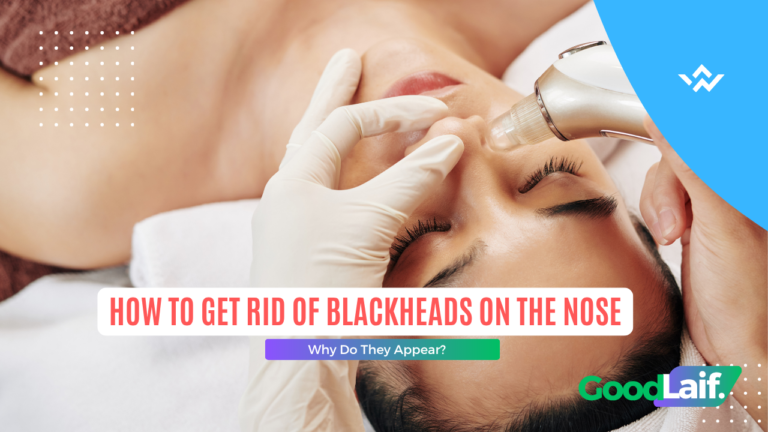 How to Get Rid of Blackheads on the Nose, Why Do They Appear?