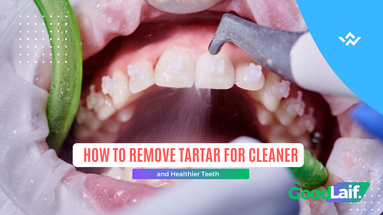 How to Remove Tartar