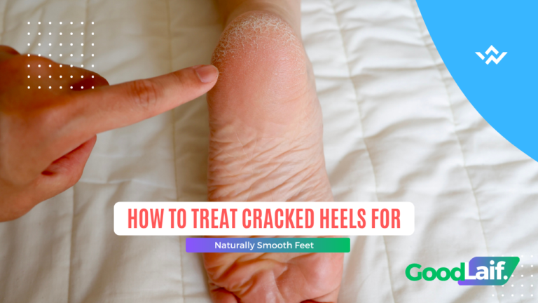 How to Treat Cracked Heels for Naturally Smooth Feet