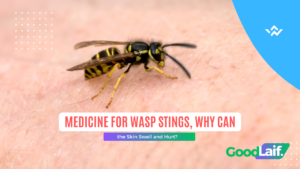 Medicine for Wasp Stings