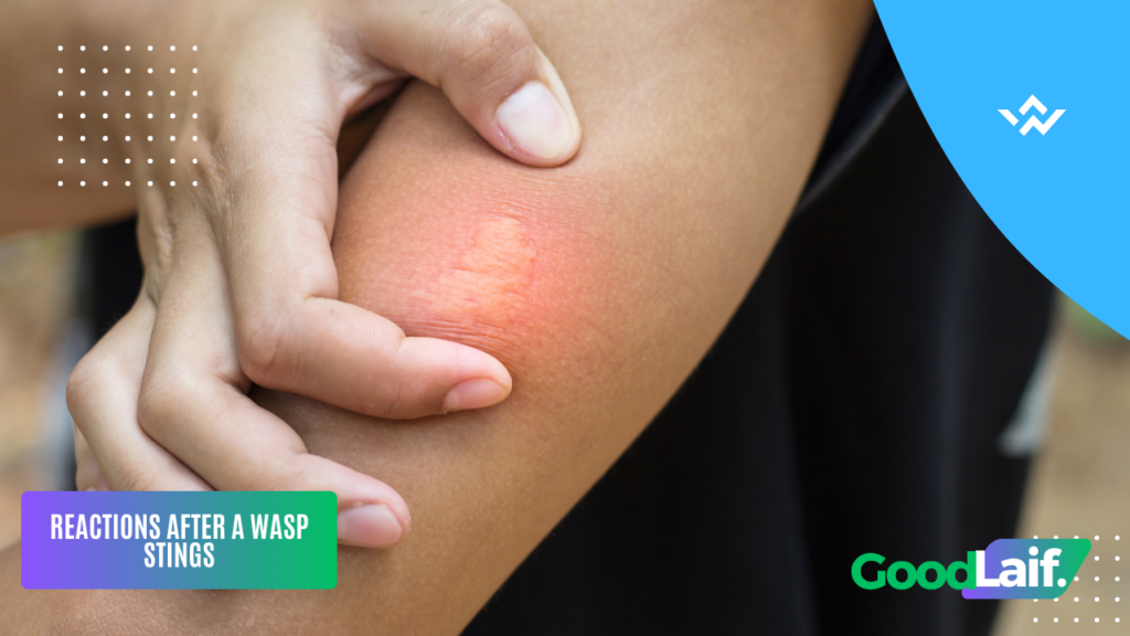Medicine for Wasp Stings