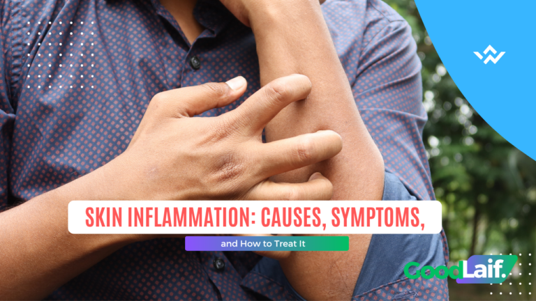 Skin Inflammation: Causes, Symptoms, and How to Treat It