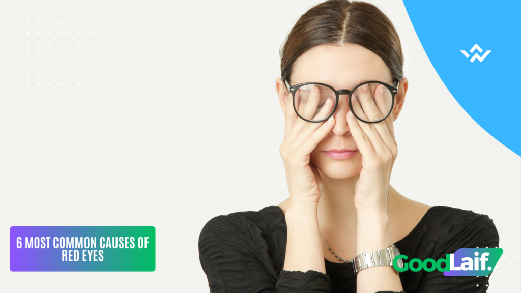 Woman with glasses covering tired eyes - illustration for how to treat red eyes from screen fatigue