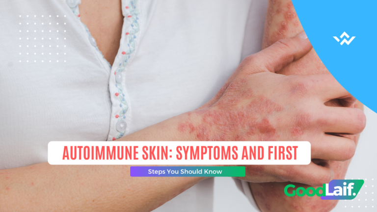 Autoimmune Skin: Symptoms and First Steps You Should Know