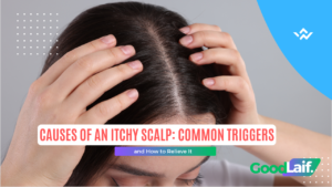 Causes of an Itchy Scalp Recognize Triggers and How to Treat It
