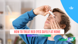 How to treat red eyes safely using artificial tear eye drops for dry eyes and mild irritation at home