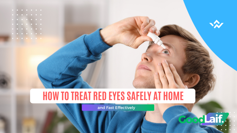 How to Treat Red Eyes Safely at Home and Fast Effectively