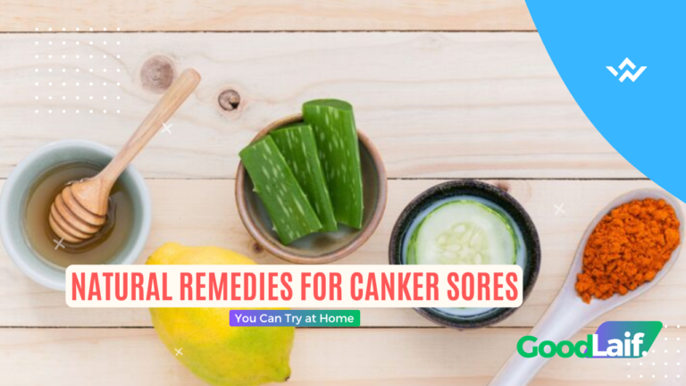 Natural Remedies for Canker Sores You Can Try at Home