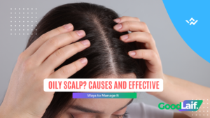 Woman touching greasy hair due to oily scalp: causes and how to treat it