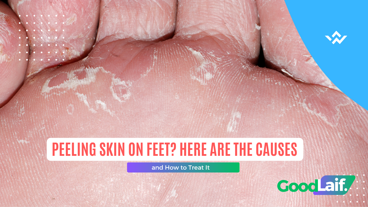 Foot care routine showing moisturizing steps to treat peeling skin on feet and keep feet healthy