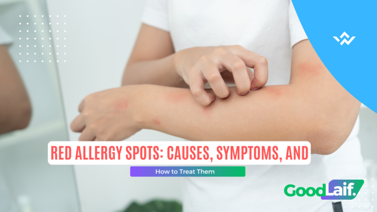 Red Allergy Spots: Causes, Symptoms, and How to Treat Them