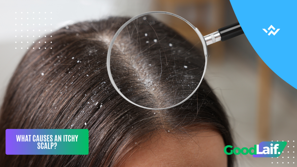 Illustration of causes of an itchy scalp due to dandruff shown on a laptop