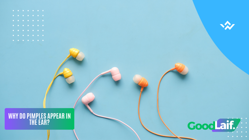 Illustration of earphones as a common cause of ear pimple due to trapped sweat, oil, and bacteria