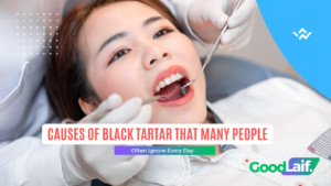 Dental checkup with a dentist to identify the causes of black tartar