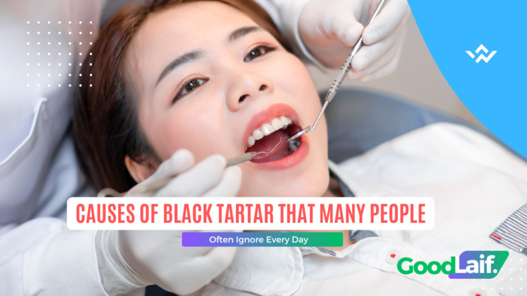 Causes of Black Tartar That Many People Often Ignore Every Day