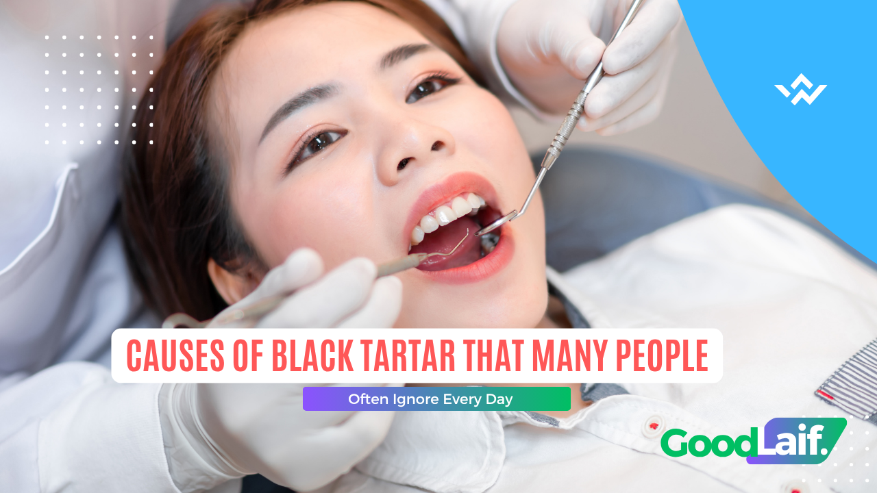 Dental checkup with a dentist to identify the causes of black tartar
