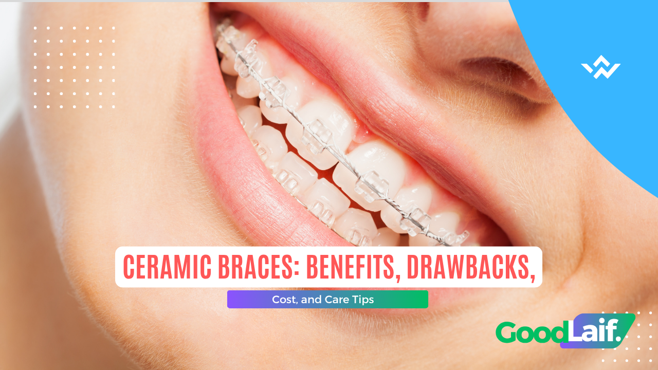 Close up smile with aesthetic ceramic braces that are barely noticeable
