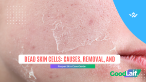 Close up of facial skin and lips with text about dead skin cells causes and how to remove them