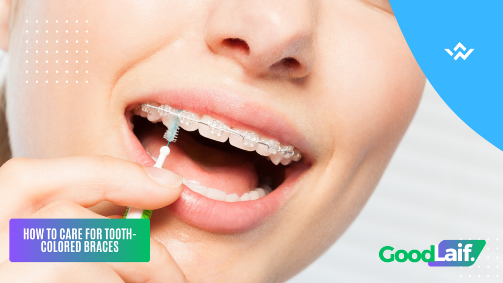 Close up of how to clean ceramic braces to keep teeth healthy