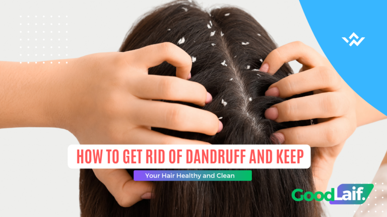 How to Get Rid of Dandruff and Keep Your Hair Healthy and Clean