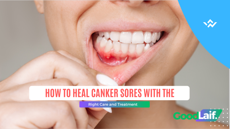 How to Heal Canker Sores with the Right Care and Treatment