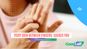 Hands scratching between fingers due to itchy skin between fingers