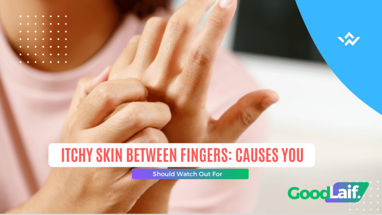 Itchy Skin Between Fingers: Causes You Should Watch Out For