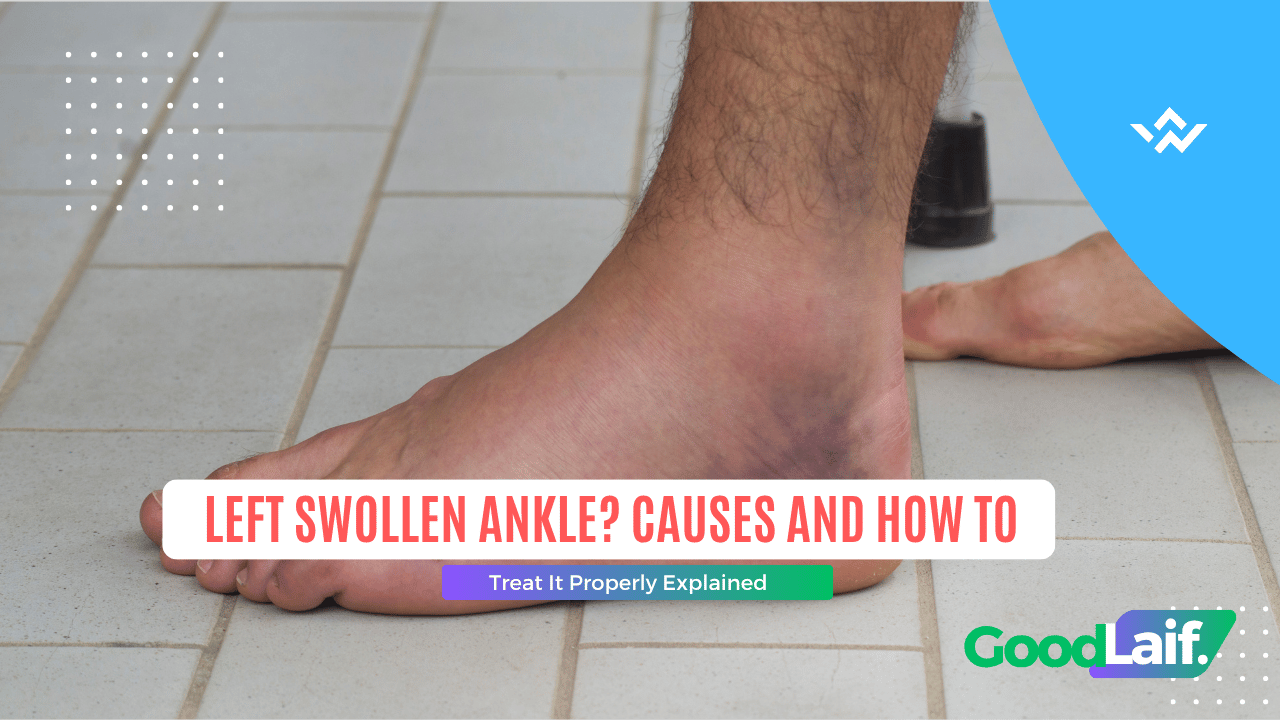 Left swollen ankle on a man's foot standing on a tiled floor