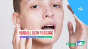 Normal Skin Purging: Learn the Signs to Avoid Making the Wrong Decision