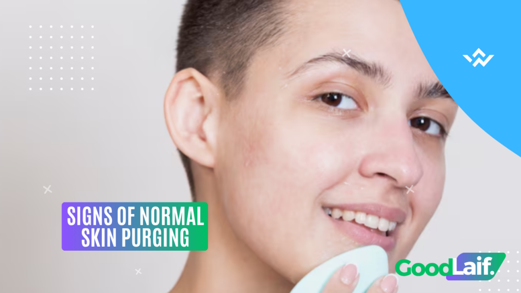 Signs of Normal Skin Purging