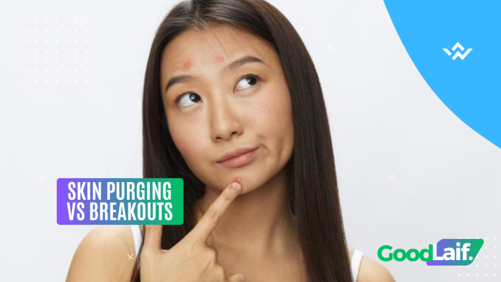 Skin Purging vs. Breakouts