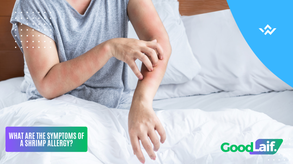 Illustration of shrimp allergy symptoms showing itchy skin on arm